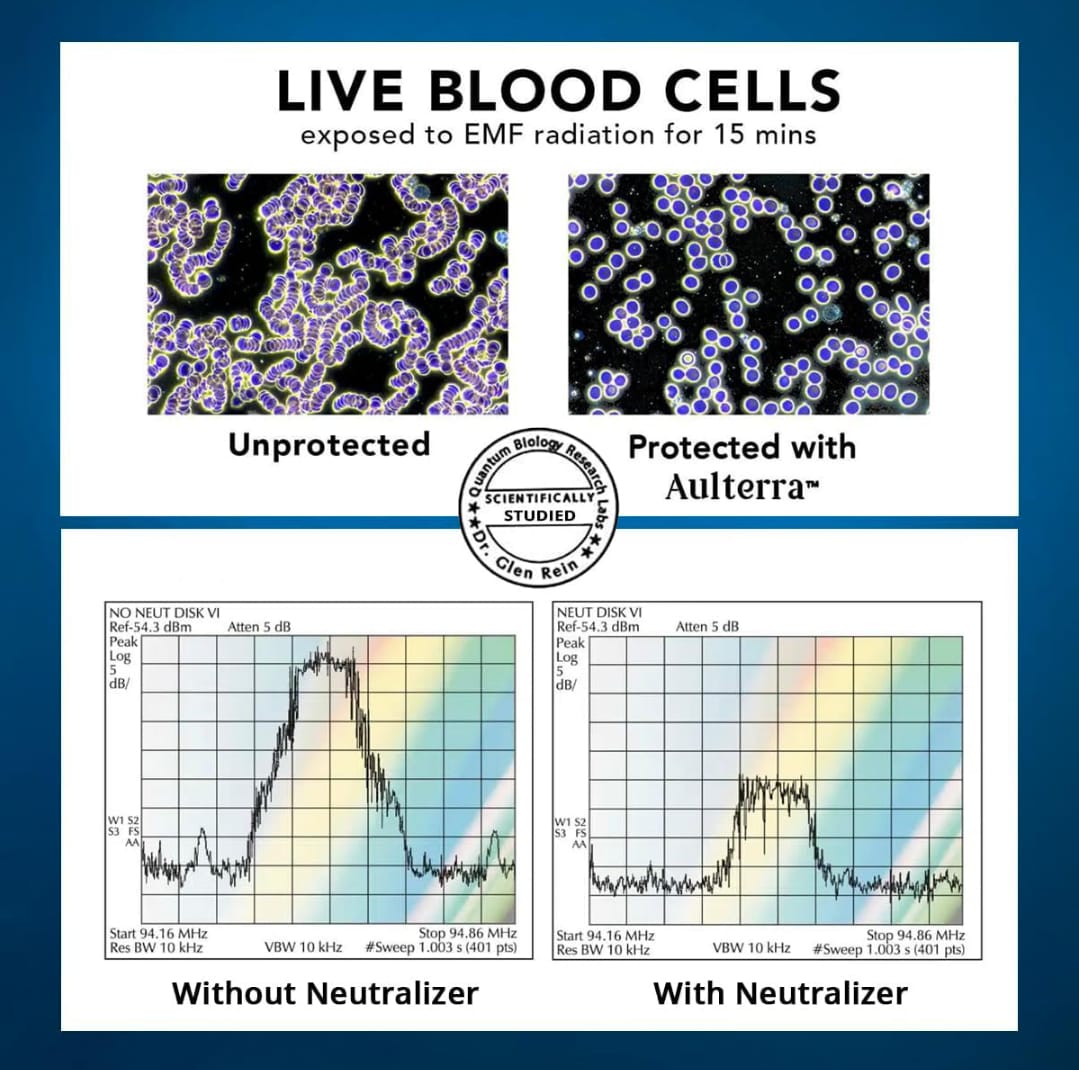 Aulterra Product Box